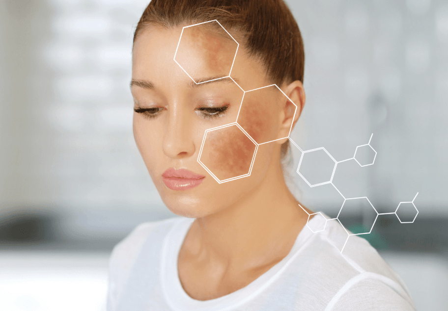 Psoriasis & Pigmentation treatment at UNI Klinik Bandar Sunway
